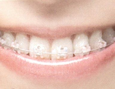 矯正治療の特徴